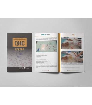 Revista QHC Anemia -Revistas