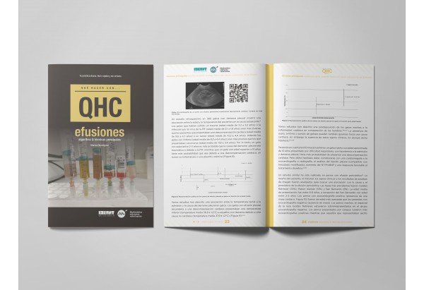 Revista QHC Efusiones -Colecciones