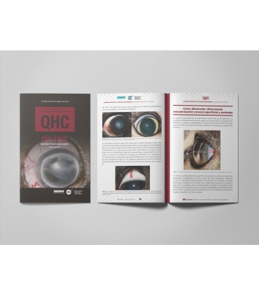 Revista QHC Ojo Rojo -Colecciones